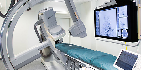 介入神经放射学