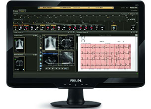 在 Philips CVIS 信息系统上监护病人的心电图