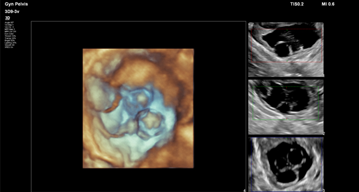 3D9-3v MPR-ov Expanded MaxVue