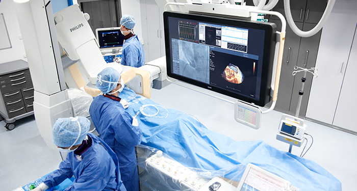 用于经导管二尖瓣修复 (TMVR) 手术的非凡的成像解决方案