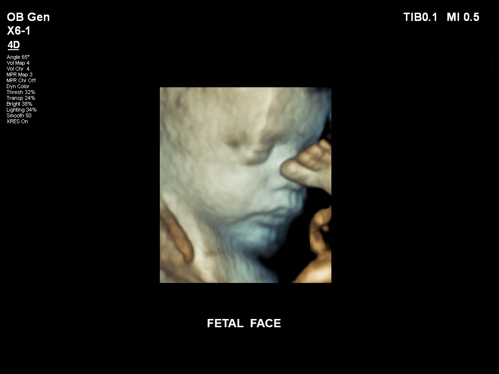 胎儿面部