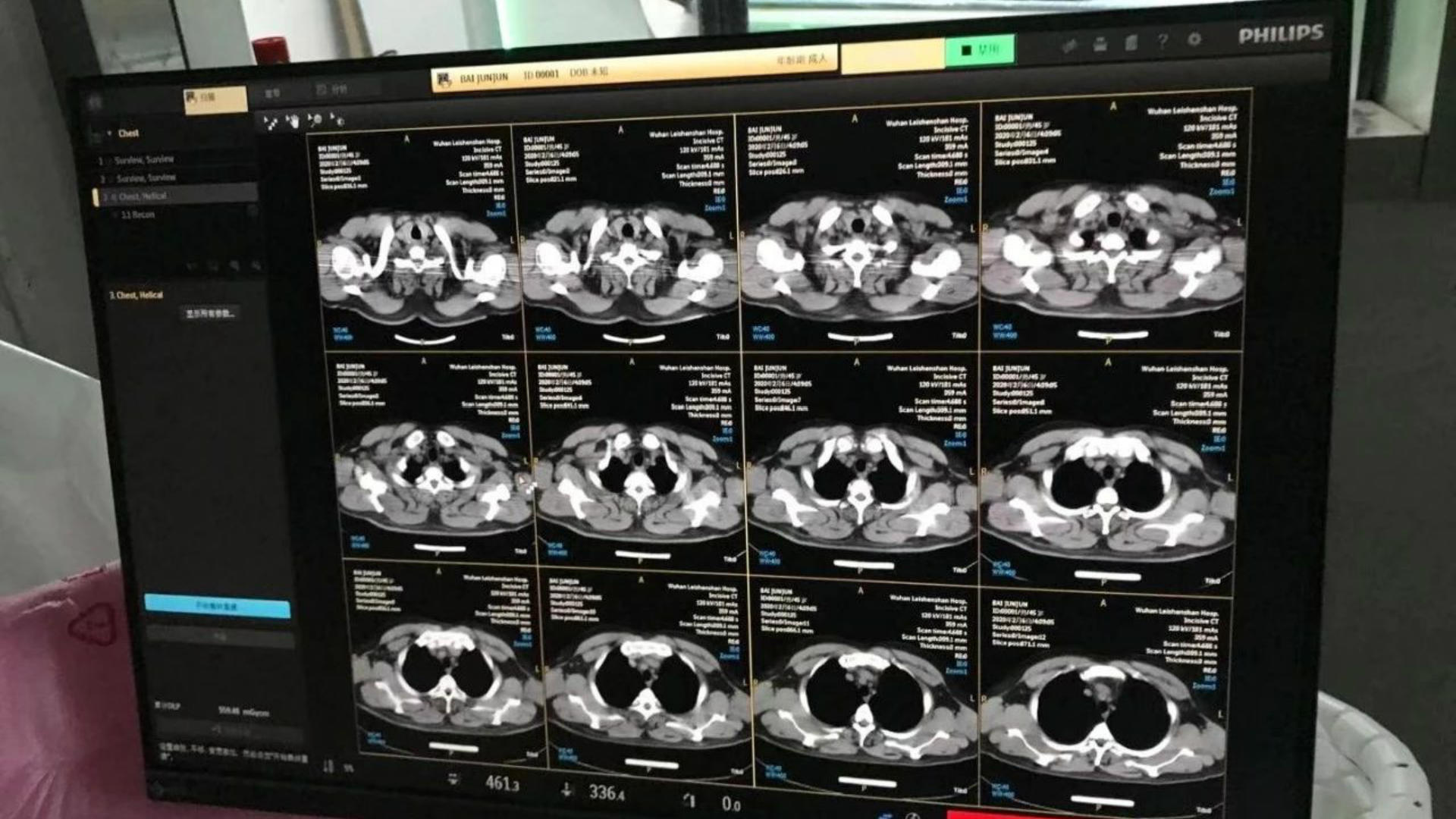 雷神山医院第一台影像诊断设备24小时安装完成